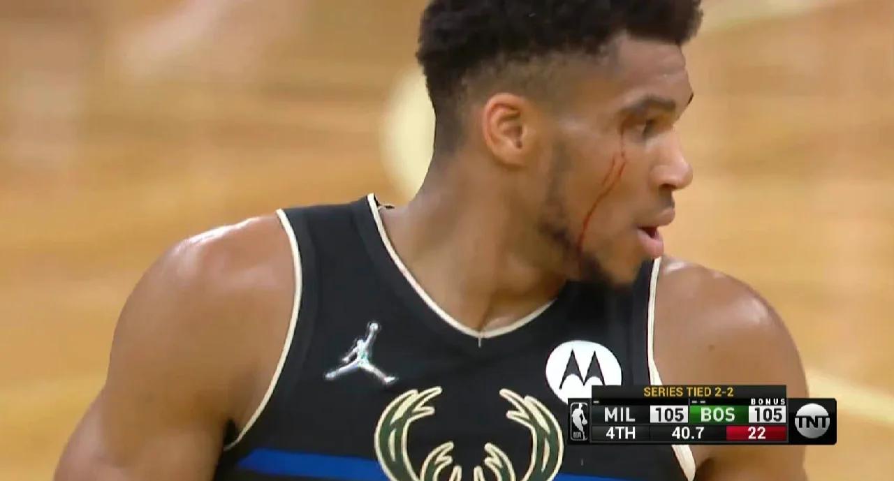 雄鹿连败，近期疲态明显展现的简单介绍